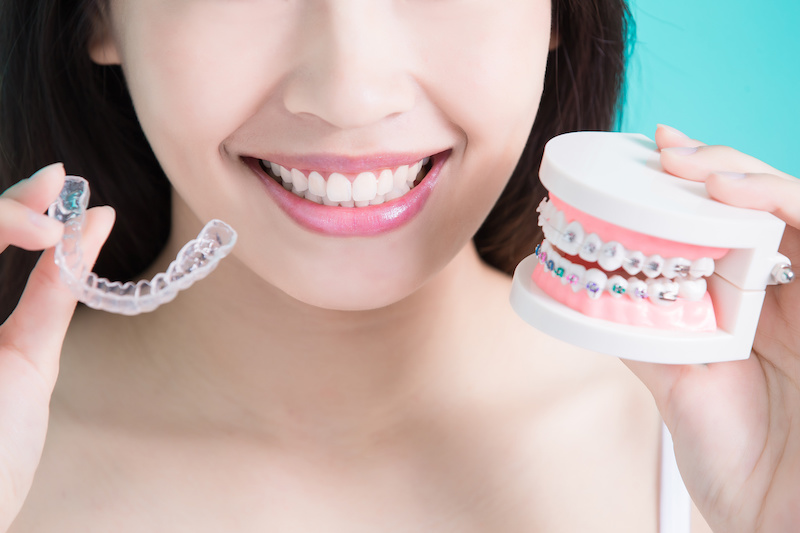 What difference between Invisalign® Clear Aligners and Traditional Metal Braces